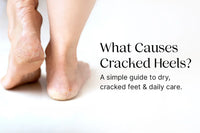 What Causes Cracked Heels? A Simple Guide to Dry, Cracked Feet & Daily Care Vanan Herbal
